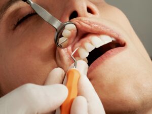 Use Your Dental Benefits Before They Expire: Maximize Your Insurance